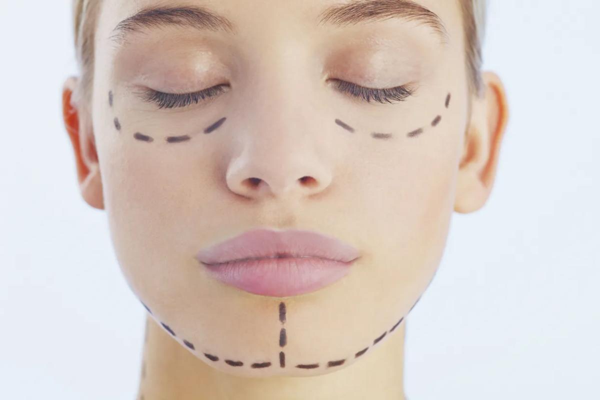 Is Getting a Facelift in Dubai the Smart Choice for You?